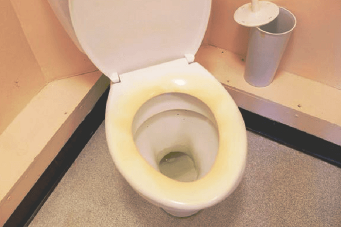 Toilet Seat Turned Yellow After Bleaching